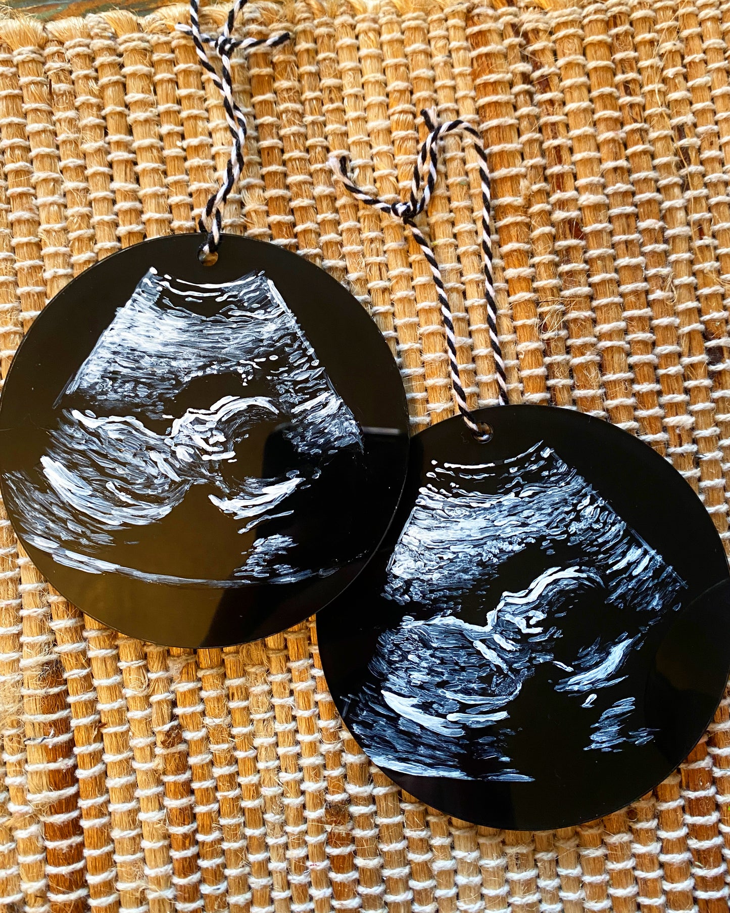Custom Handpainted Ultrasound Ornament