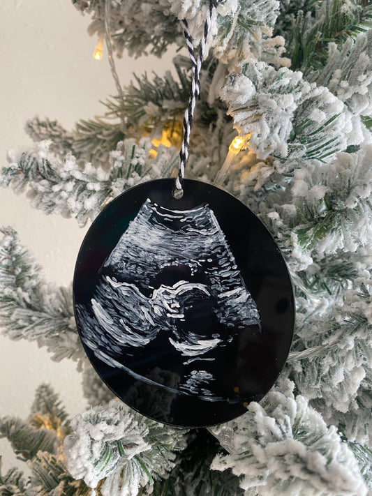 Custom Handpainted Ultrasound Ornament